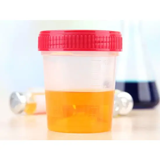Catecholamines Fractionated, 24-Hour Urine